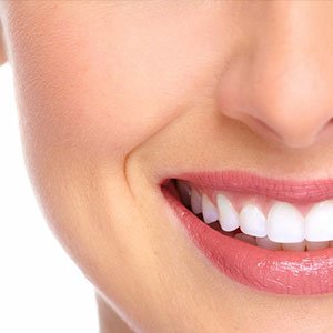 Dental Veneers in Turkey