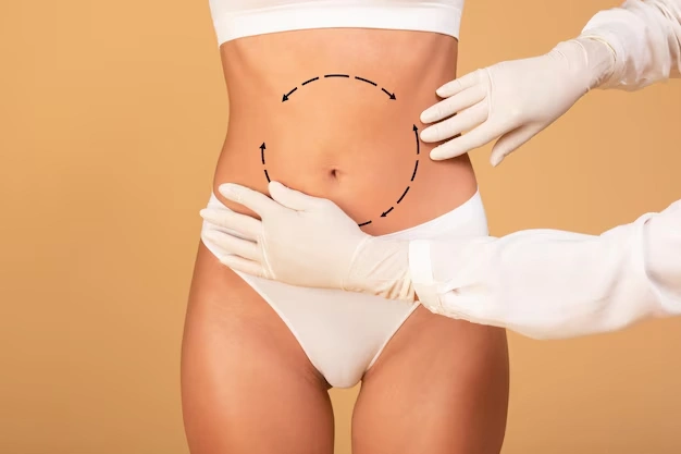 How to Choose Between Liposuction and CoolSculpting 4 body aesthetic surgeries Turkey Istanbul Cost 11