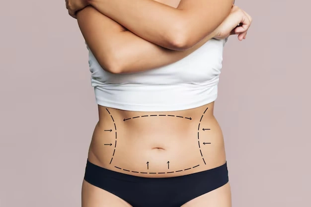 body aesthetic surgeries Turkey Istanbul Cost 33