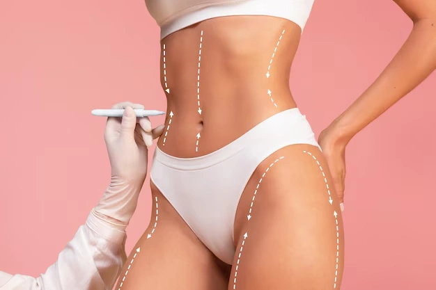 How to Manage Pain After Liposuction or BBL 8 body aesthetic surgeries Turkey Istanbul Cost 35