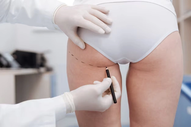 body aesthetic surgeries Turkey Istanbul Cost 57