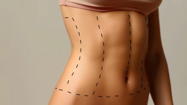 body aesthetic surgeries Turkey Istanbul Cost 75