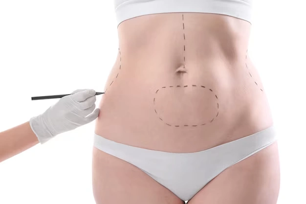 body aesthetic surgeries Turkey Istanbul Cost 82