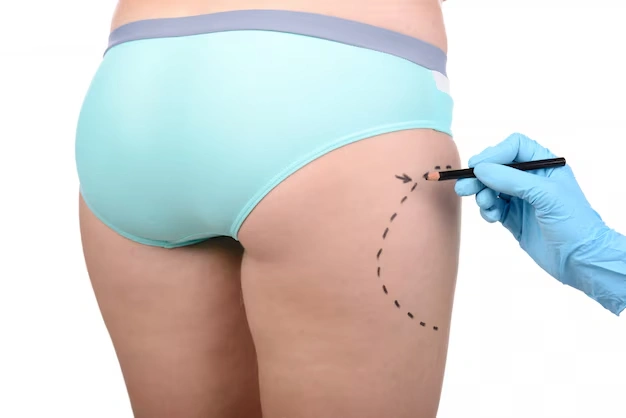 body aesthetic surgeries Turkey Istanbul Cost 19