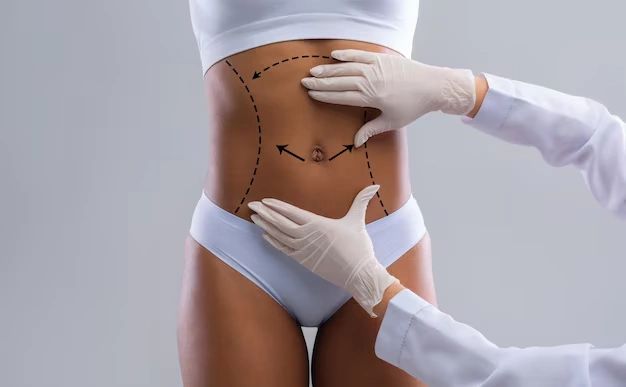 body aesthetic surgeries Turkey Istanbul Cost 37