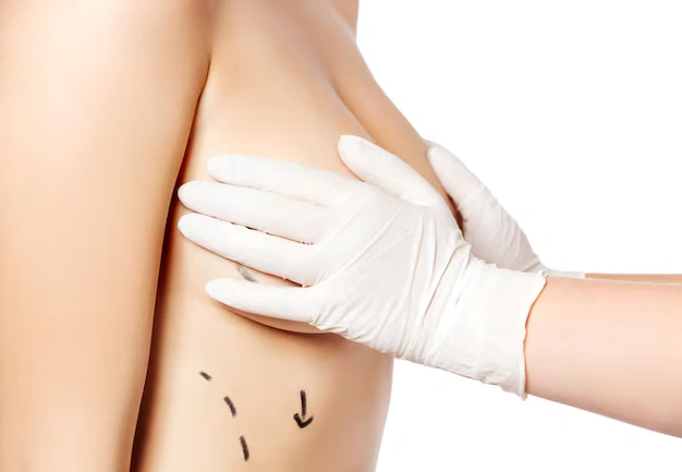 breast aesthetic surgeries Turkey Istanbul Cost 22 1