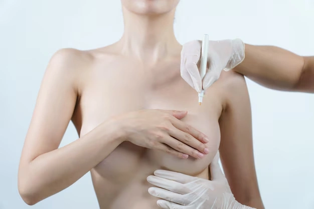 Breast Implant Safety: What Every Patient Should Know Before Surgery 3 breast aesthetic surgeries Turkey Istanbul Cost 37 1