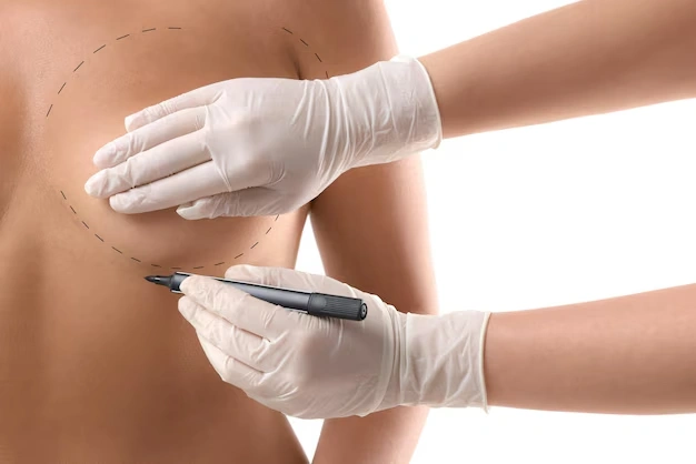 breast aesthetic surgeries Turkey Istanbul Cost 50 1
