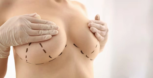 breast aesthetic surgeries Turkey Istanbul Cost 98 1