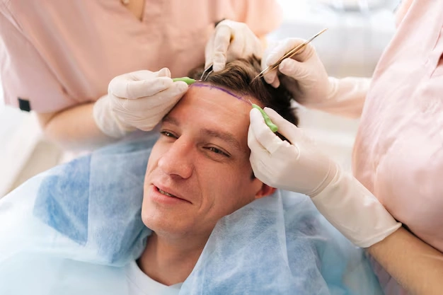 Hair Transplant Operations Turkey Istanbul Before After Cost 24